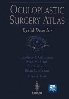 Paperback Oculoplastic Surgery Atlas: Eyelid Disorders Book