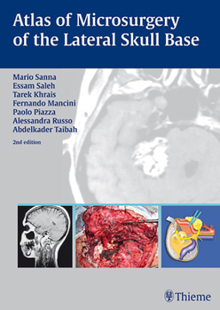 Hardcover Atlas of Microsurgery of the Lateral Skull Base Book