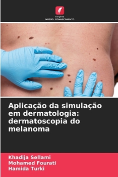 Paperback Aplicação da simulação em dermatologia: dermatoscopia do melanoma [Portuguese] Book