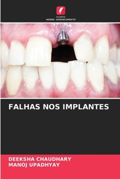 Paperback Falhas Nos Implantes [Portuguese] Book