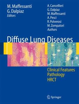 Paperback Diffuse Lung Diseases: Clinical Features, Pathology, Hrct Book