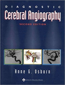 Hardcover Diagnostic Cerebral Angiography Book