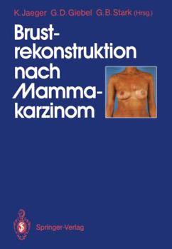 Paperback Brustrekonstruktion Nach Mammakarzinom [German] Book