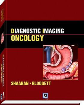 Hardcover Diagnostic Imaging: Oncology Book