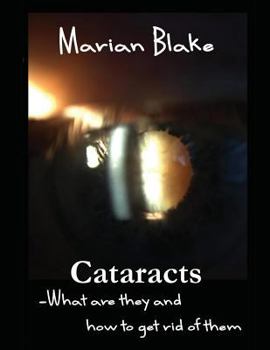 Paperback Cataracts: What are they and how to get rid of them? [Large Print] Book