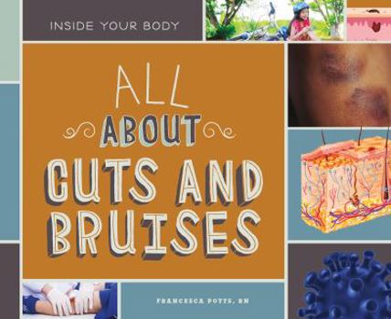 All about Cuts and Bruises - Book  of the Inside Your Body