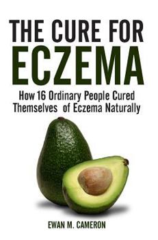 Hardcover The Cure for Eczema Book
