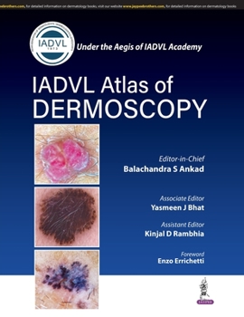 Paperback Atlas of Dermoscopy Book
