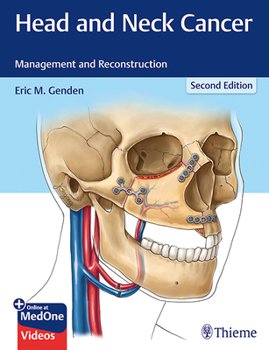 Hardcover Head and Neck Cancer: Management and Reconstruction Book