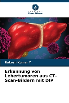 Paperback Erkennung von Lebertumoren aus CT-Scan-Bildern mit DIP [German] Book