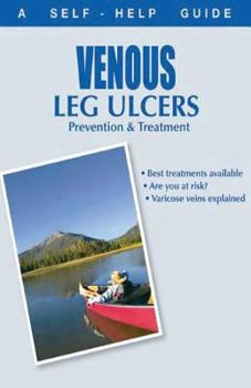 Paperback The Doctor's Guide to: Venous Leg Ulcers: Prevention and Treatment Book