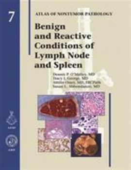 Hardcover Benign and Reactive Conditions of Lymph Node and Spleen Book