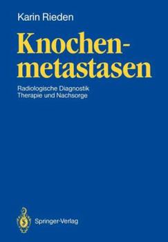 Paperback Knochenmetastasen: Radiologische Diagnostik, Therapie Und Nachsorge [German] Book