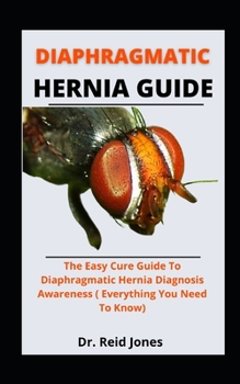 Paperback Diaphragmatic Hernia Guide: The Easy Cure Guide To Diaphragmatic Hernia Diagnoses Awareness (Everything You Need To Know) Book
