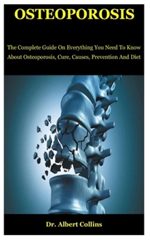 Paperback Osteoporosis: The Complete Guide On Everything You Need To Know About Osteoporosis, Cure, Causes, Prevention And Diet Book