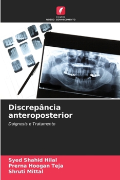 Paperback Discrepância anteroposterior [Portuguese] Book