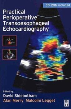 Paperback Practical Perioperative Transoesophageal Echocardiography: Text with CD-ROM [With CDROM] Book