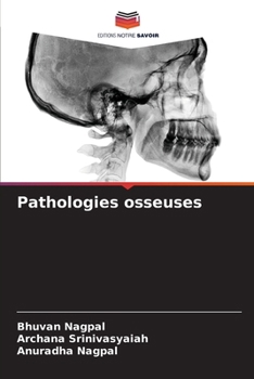 Paperback Pathologies osseuses [French] Book