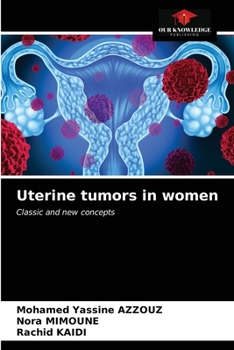 Paperback Uterine tumors in women Book