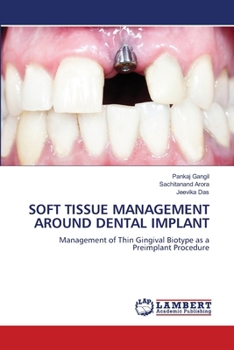 Soft Tissue Management Around Dental Implant