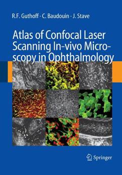 Paperback Atlas of Confocal Laser Scanning In-Vivo Microscopy in Ophthalmology: Principles and Applications in Diagnostic and Therapeutic Ophtalmology Book