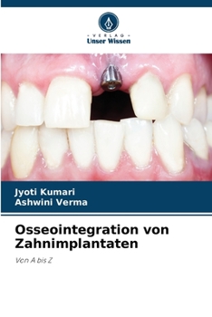 Paperback Osseointegration von Zahnimplantaten [German] Book