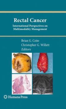 Paperback Rectal Cancer: International Perspectives on Multimodality Management Book