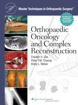 Hardcover Master Techniques in Orthopaedic Surgery: Orthopaedic Oncology and Complex Reconstruction Book