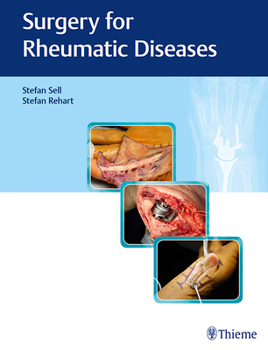 Hardcover Surgery for Rheumatic Diseases Book