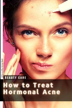 Paperback How t? Treat Hormonal Acne: Why ?s My Acne Bad? Book