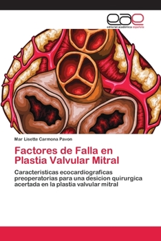 Paperback Factores de Falla en Plastia Valvular Mitral [Spanish] Book