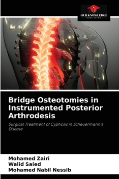 Paperback Bridge Osteotomies in Instrumented Posterior Arthrodesis Book