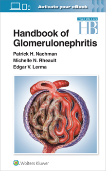 Paperback Handbook of Glomerulonephritis Book