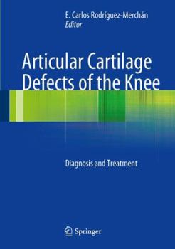 Hardcover Articular Cartilage Defects of the Knee: Diagnosis and Treatment Book