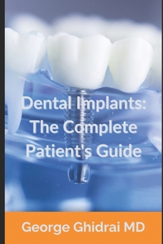Paperback Dental Implants: The Complete Patient's Guide Book