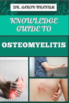 KNOWLEDGE GUIDE TO OSTEOMYELITIS: Essential Manual To Diagnosis, Treatment, Prevention, and Advanced Therapies for Bone Infection Management