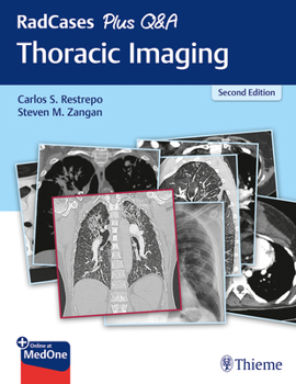 Paperback Radcases Plus Q&A Thoracic Imaging Book