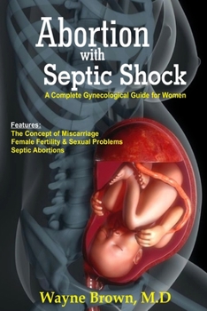 Paperback Abortion with Septic Shock: A Complete Gynecological Guide for Women Book