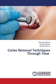 Paperback Caries Removal Techniques Through Time Book