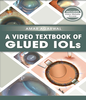 Paperback A Video Textbook of Glued Iols Book