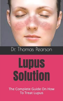 Paperback Lupus Solution: The Complete Guide On How To Treat Lupus Book