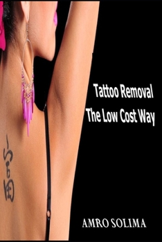 Tattoo Removal: The Low Cost Way