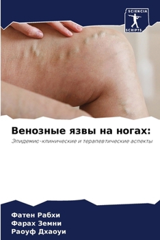 Paperback Венозные язвы на ногах [Russian] Book