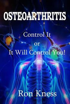 Paperback Osteoarthritis: Control It or It Will Control You Book