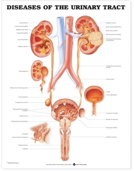 Wall Chart Diseases of the Urinary Tract Anatomical Chart Book