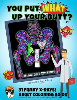 Paperback You Put What Up Your Butt? Funny Adult Coloring Book for Radiologists, X-Ray Techs, Nurses & Doctors (Midnight Edition) Book