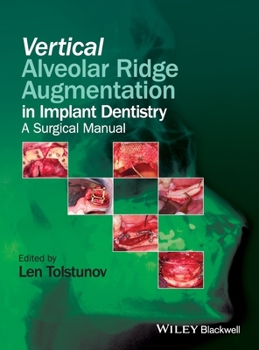 Hardcover Vertical Alveolar Ridge Augmentation in Implant Dentistry: A Surgical Manual Book