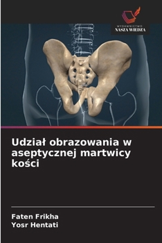 Udzial obrazowania w aseptycznej martwicy kosci (Polish Edition)
