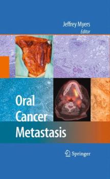 Hardcover Oral Cancer Metastasis Book