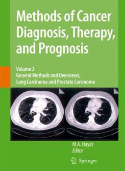 Hardcover Methods of Cancer Diagnosis, Therapy, and Prognosis, Volume 2: General Methods and Overviews, Lung Carcinoma and Prostate Carcinoma Book